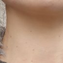 금오대로-2 | 구미 피부관리 북삼 차이브 스킨케어 잡티제거 솔직 후기