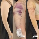 인천 송도다이어트 팔람스 2주차 일상생활 멍붓기 후기