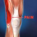 PT의 정석 운동재활센터 이미지