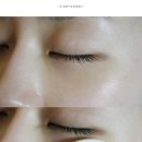 림팩트