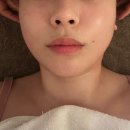 루체떼 | 범내골역윤곽관리 루체떼에스테틱 작은얼굴관리후기