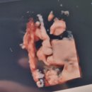 노블클라쎄산부인과의원 이미지