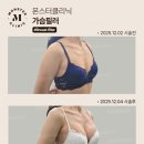 더힐즈의원 | 가슴필러 부작용, 시술 전후의 주의사항 그리고 회복기간 핵심 정리