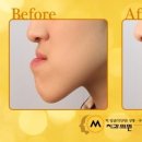 예쁜브이라인의원 이미지