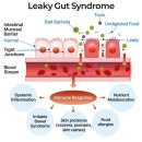 시아플렉스 밤 vs 에스드림 이미지
