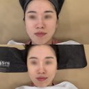 창원 여드름관리 르메이 에스테틱 트러블리셋케어 후기 (주차정보, 붉은기 완화)