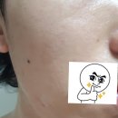 비케이킹 | 촉촉한 기초화장품 추천!! 자연의 벗 스킨 토너&로션 세트 (Nature's Friend Skin Toner & Lotion)