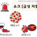 저혈압 쇼크 증상 원인 예방법 이미지