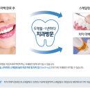 미백천사
