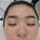 거제 만족도 높은 옥포피부관리 끌레르 에스테틱 물방울리프팅 후기