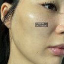 다인바이오(주) | 트러블피부에 딱! 피지압출팩 이옴트러블패치마스크