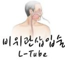 위관영양 비위관삽입 (L-tube) 경관영양법 이미지