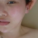 리메디온 이미지