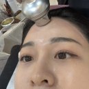 홍 헤어라인 이미지