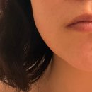 힐바이오 | 강남 피부관리 프롬미 강남본점 바이오힐 후기