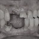 리온치과기공소 이미지