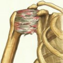 비노한의원 | 대구중구대신동남산동청라언덕역한의원_어깨가 안 올라가고 아픈가요 ?오십견∙동결견 (유착성 관절낭염)