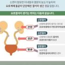 결석 요로결석 결석의 원인 결석에 좋은 약초 이미지