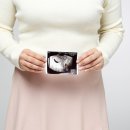 정지영산부인과의원 네이버블로그