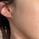 (주)채움 | 더채움에스테틱 스페셜 필링 3주 후기 피부톤 개선