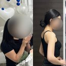 팔뚝 지흡 가격 / 인천지방흡입병원 13주차 후기 / 부작용, 후관리까지