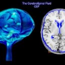 뇌척수액 (CSF) 이미지