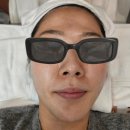 광주 수완지구 365메디스킨 여드름관리 플라즈마후기