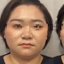 윤피부사랑 이미지