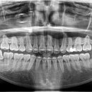 더바른윤치과의원 이미지