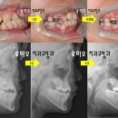 로미오치과교정과치과의원 이미지