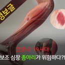 코로나19시대 보조심장 종아리가 위험하다 이미지