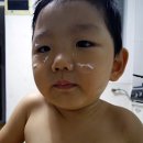 엘스케어 이미지