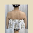 선 에스테딕 네이버블로그