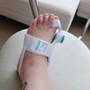 센스생활의료기 | 에버바디 발가락교정기 PRO 내 발에 맞춘 편안한 무지외반증교정기 솔직 후기