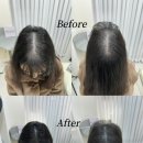 채움기프트 | SMP 정수리 두피커버 실패 경험 후 재도전한 ‘브로우기프트’ 찐만족 후기