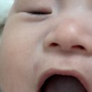 젖니 꽃이 피었습니다 이미지