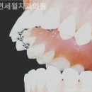 서울윌치과 이미지