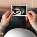 누가한의원 이미지