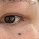 미코뷰티 | 내돈내산 대구 문신 타투 미인 점 제거 하는 곳 추천 ‘미코뷰티’ 2회차 제거 + 올리브영 향수추천