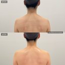 월횡경로당 | 분당 정자역 에스테틱 #에스테틱다리아 분당정자점 #여배우윤곽축소 만족후기