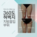 미다스의원 이미지