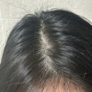 소이랩 리얼 블랙빈 두피 샴푸 후기 ㅣ탈모 증상 완화 & 머릿결 케어, 검은콩 샴푸 추천