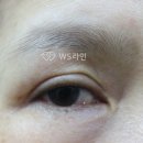 부천눈썹문신후기 ws라인피부과 반영구병원에서 제대로 하세요
