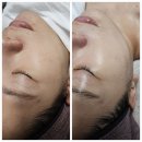 퀸스테틱 | 거조한 피부관리 가능한 다산동에스테틱 아이퀸에스테틱 남양주점