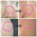 7월7일 | rdrd 레드 애플 락토 진정 세럼 체험단 7일 사용 후기