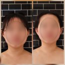 검암라라뷰티스파 윤곽관리 JH윤곽술메타 후기