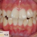 연세미소담은치과 이미지