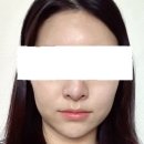 보령프라자 | 보령 스킨포레스트 솔직후기(보령웨딩관리/피부분석진단/라인뷰)