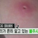 불주사 - 1216 | 불주사