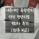 [결혼준비💍] 05. 더작 청량리점 더 작은 얼굴 조형 윤곽 9회차 후기(전/후 비교 사진)